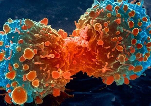 tumori cellule