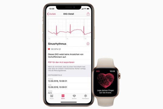 Apple Watch, l’app ECG in Italia per l’elettrocardiogramma