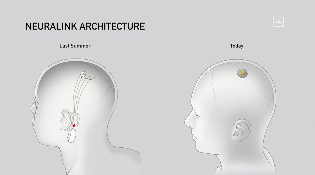 Architettura Neuralink
